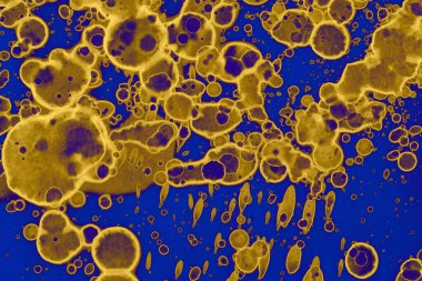 Soyut mavi sarı arka plan. Lekeler ve kabarcıklar. Alkol mürekkebi sanatı. Sembol.