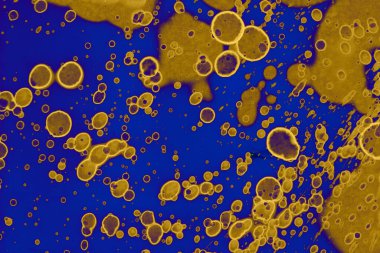 Soyut mavi sarı arka plan. Lekeler ve kabarcıklar. Alkol mürekkebi sanatı. Sembol.