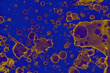 Soyut mavi sarı arka plan. Lekeler ve kabarcıklar. Alkol mürekkebi sanatı. Sembol.