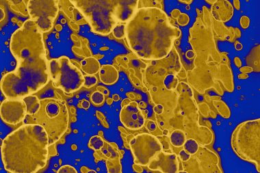 Soyut mavi sarı arka plan. Lekeler ve kabarcıklar. Alkol mürekkebi sanatı. Sembol.