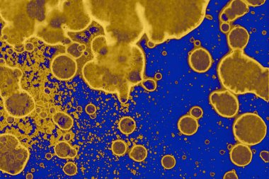 Soyut mavi sarı arka plan. Lekeler ve kabarcıklar. Alkol mürekkebi sanatı. Sembol.