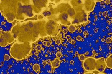 Soyut mavi sarı arka plan. Lekeler ve kabarcıklar. Alkol mürekkebi sanatı. Sembol.