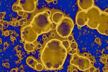 Soyut mavi sarı arka plan. Lekeler ve kabarcıklar. Alkol mürekkebi sanatı. Sembol.