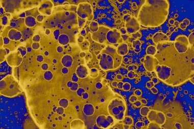 Soyut mavi sarı arka plan. Lekeler ve kabarcıklar. Alkol mürekkebi sanatı. Sembol.