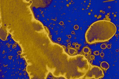 Soyut mavi sarı arka plan. Lekeler ve kabarcıklar. Alkol mürekkebi sanatı. Sembol.