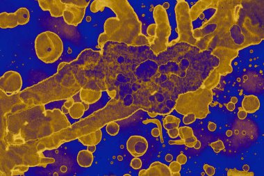 Soyut mavi sarı arka plan. Lekeler ve kabarcıklar. Alkol mürekkebi sanatı. Sembol.