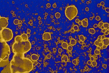 Soyut mavi sarı arka plan. Lekeler ve kabarcıklar. Alkol mürekkebi sanatı. Sembol.