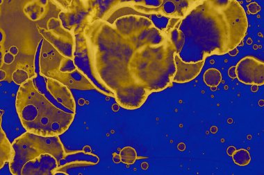 Soyut mavi sarı arka plan. Lekeler ve kabarcıklar. Alkol mürekkebi sanatı. Sembol.