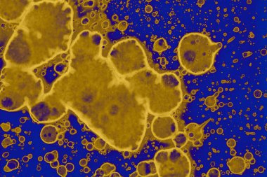 Soyut mavi sarı arka plan. Lekeler ve kabarcıklar. Alkol mürekkebi sanatı. Sembol.