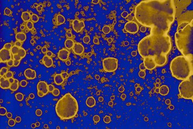 Soyut mavi sarı arka plan. Lekeler ve kabarcıklar. Alkol mürekkebi sanatı. Sembol.