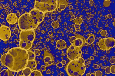 Soyut mavi sarı arka plan. Lekeler ve kabarcıklar. Alkol mürekkebi sanatı. Sembol.