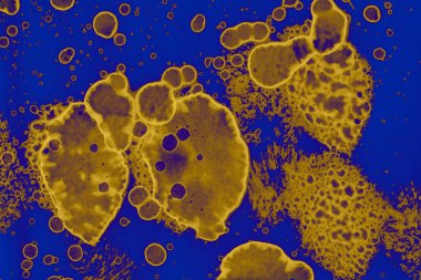 Soyut mavi sarı arka plan. Lekeler ve kabarcıklar. Alkol mürekkebi sanatı. Sembol.