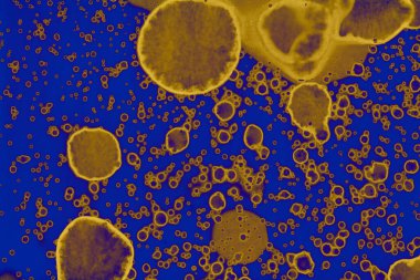 Soyut mavi sarı arka plan. Lekeler ve kabarcıklar. Alkol mürekkebi sanatı. Sembol.