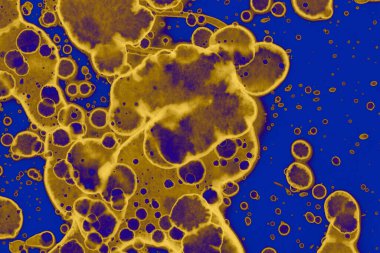 Soyut mavi sarı arka plan. Lekeler ve kabarcıklar. Alkol mürekkebi sanatı. Sembol.