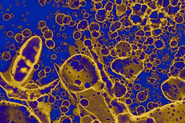 Soyut mavi sarı arka plan. Lekeler ve kabarcıklar. Alkol mürekkebi sanatı. Sembol.