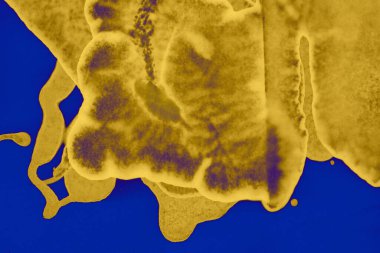 Soyut mavi sarı arka plan. Lekeler ve kabarcıklar. Alkol mürekkebi sanatı. Sembol.