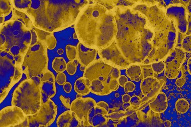 Soyut mavi sarı arka plan. Lekeler ve kabarcıklar. Alkol mürekkebi sanatı. Sembol.