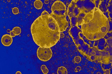 Soyut mavi sarı arka plan. Lekeler ve kabarcıklar. Alkol mürekkebi sanatı. Sembol.