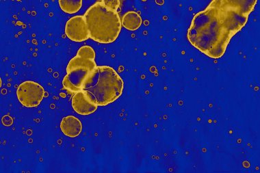 Soyut mavi sarı arka plan. Lekeler ve kabarcıklar. Alkol mürekkebi sanatı. Sembol.