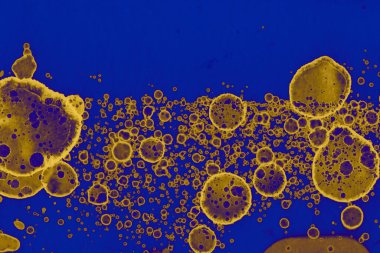 Soyut mavi sarı arka plan. Lekeler ve kabarcıklar. Alkol mürekkebi sanatı. Sembol.