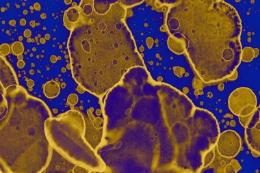 Soyut mavi sarı arka plan. Lekeler ve kabarcıklar. Alkol mürekkebi sanatı. Sembol.