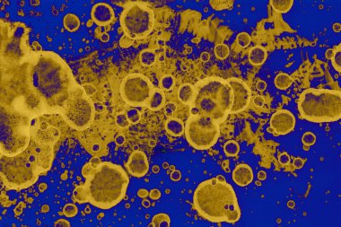 Soyut mavi sarı arka plan. Lekeler ve kabarcıklar. Alkol mürekkebi sanatı. Sembol.