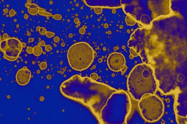 Soyut mavi sarı arka plan. Lekeler ve kabarcıklar. Alkol mürekkebi sanatı. Sembol.