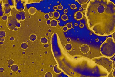 Soyut mavi sarı arka plan. Lekeler ve kabarcıklar. Alkol mürekkebi sanatı. Sembol.