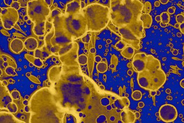 Soyut mavi sarı arka plan. Lekeler ve kabarcıklar. Alkol mürekkebi sanatı. Sembol.