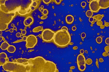 Soyut mavi sarı arka plan. Lekeler ve kabarcıklar. Alkol mürekkebi sanatı. Sembol.