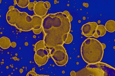 Soyut mavi sarı arka plan. Lekeler ve kabarcıklar. Alkol mürekkebi sanatı. Sembol.