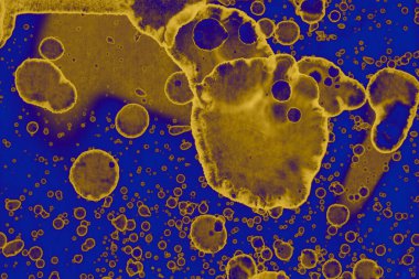 Soyut mavi sarı arka plan. Lekeler ve kabarcıklar. Alkol mürekkebi sanatı. Sembol.