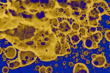 Soyut mavi sarı arka plan. Lekeler ve kabarcıklar. Alkol mürekkebi sanatı. Sembol.