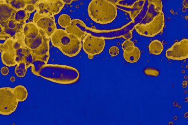 Soyut mavi sarı arka plan. Lekeler ve kabarcıklar. Alkol mürekkebi sanatı. Sembol.