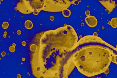 Soyut mavi sarı arka plan. Lekeler ve kabarcıklar. Alkol mürekkebi sanatı. Sembol.