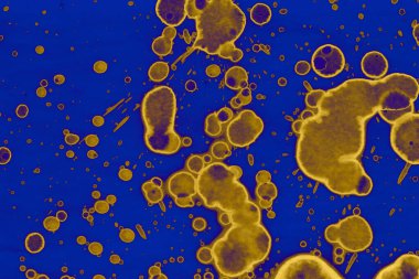 Soyut mavi sarı arka plan. Lekeler ve kabarcıklar. Alkol mürekkebi sanatı. Sembol.