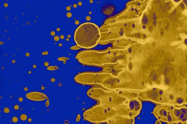 Soyut mavi sarı arka plan. Lekeler ve kabarcıklar. Alkol mürekkebi sanatı. Sembol.