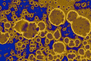 Soyut mavi sarı arka plan. Lekeler ve kabarcıklar. Alkol mürekkebi sanatı. Sembol.