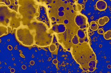 Soyut mavi sarı arka plan. Lekeler ve kabarcıklar. Alkol mürekkebi sanatı. Sembol.