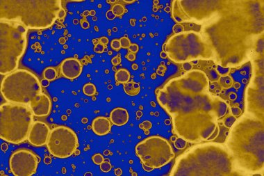 Soyut mavi sarı arka plan. Lekeler ve kabarcıklar. Alkol mürekkebi sanatı. Sembol.