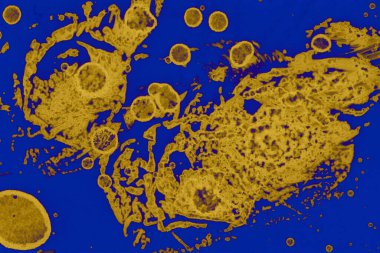 Soyut mavi sarı arka plan. Lekeler ve kabarcıklar. Alkol mürekkebi sanatı. Sembol.