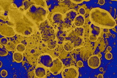 Soyut mavi sarı arka plan. Lekeler ve kabarcıklar. Alkol mürekkebi sanatı. Sembol.