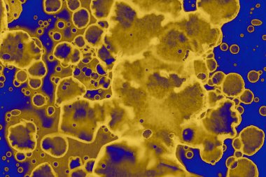 Soyut mavi sarı arka plan. Lekeler ve kabarcıklar. Alkol mürekkebi sanatı. Sembol.