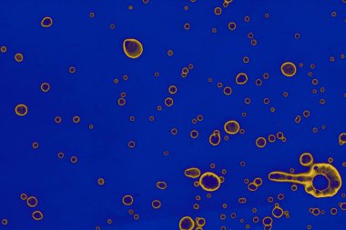 Soyut mavi sarı arka plan. Lekeler ve kabarcıklar. Alkol mürekkebi sanatı. Sembol.