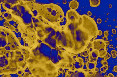 Soyut mavi sarı arka plan. Lekeler ve kabarcıklar. Alkol mürekkebi sanatı. Sembol.