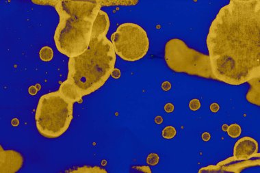 Abstract blue yellow background. Blots and bubbles. The art of alcohol ink. Symbol.