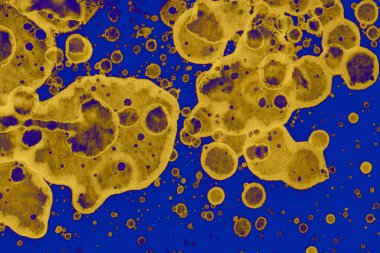 Soyut mavi sarı arka plan. Lekeler ve kabarcıklar. Alkol mürekkebi sanatı. Sembol.