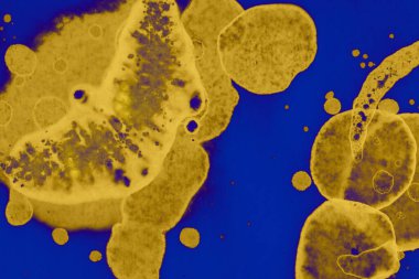 Soyut mavi sarı arka plan. Lekeler ve kabarcıklar. Alkol mürekkebi sanatı. Sembol.