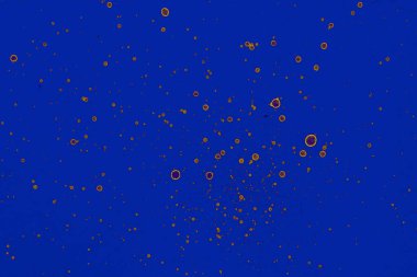 Soyut mavi sarı arka plan. Lekeler ve kabarcıklar. Alkol mürekkebi sanatı. Sembol.