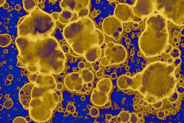 Soyut mavi sarı arka plan. Lekeler ve kabarcıklar. Alkol mürekkebi sanatı. Sembol.